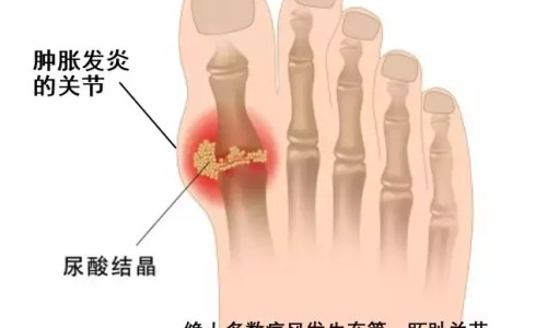 红花金樱子-红金樱功效网 | 金樱子和红参泡水功效,金樱子红花的功效与作用